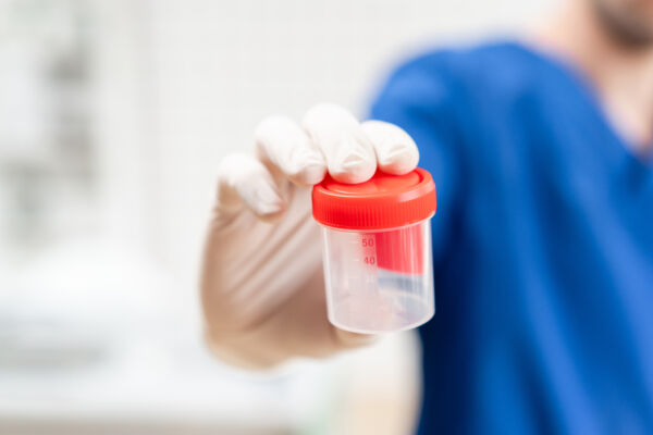 image of Urine sample cup for visual effect 